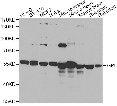 GPI Antibody - Western blot analysis of extracts of various cell lines, using GPI antibody at 1:1000 dilution. The secondary antibody used was an HRP Goat Anti-Rabbit IgG (H+L) at 1:10000 dilution. Lysates were loaded 25ug per lane and 3% nonfat dry milk in TBST was used for blocking. An ECL Kit was used for detection and the exposure time was 90s.