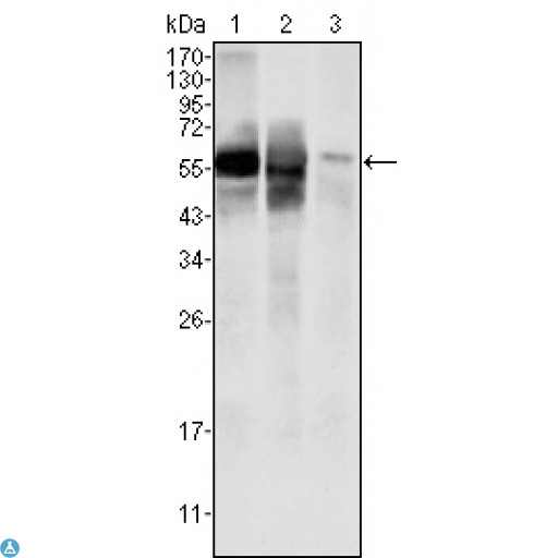 GPI Antibody - Western Blot (WB) analysis using GPI Monoclonal Antibody against HepG2 (1) , SMMC-7721 (2) cell lysate and rat liver tissues lysate (3).