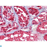 GPI Antibody - Immunohistochemistry (IHC) analysis of paraffin-embedded Human Kidney tissues with AEC staining using GPI Monoclonal Antibody.
