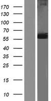 GPI Protein - Western validation with an anti-DDK antibody * L: Control HEK293 lysate R: Over-expression lysate