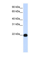 GPI3 / PIGA Antibody - PIGA antibody Western blot of Placenta lysate. This image was taken for the unconjugated form of this product. Other forms have not been tested.