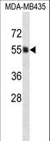 GPI3 / PIGA Antibody - PIGA Antibody western blot of MDA-MB435 cell line lysates (35 ug/lane). The PIGA antibody detected the PIGA protein (arrow).