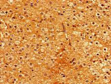 GPI3 / PIGA Antibody - Immunohistochemistry image of paraffin-embedded human adrenal gland tissue at a dilution of 1:100