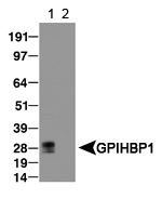 GPIHBP1 Antibody - Detection of Gpihbp1 in transfected lysate (Lane 1). AN empty vector lysate was used as a negative control (Lane 2).  This image was taken for the unconjugated form of this product. Other forms have not been tested.