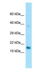 GPIHBP1 Antibody - GPIHBP1 antibody Western Blot of HepG2.  This image was taken for the unconjugated form of this product. Other forms have not been tested.