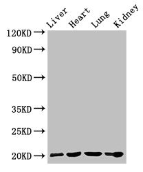 GPIHBP1 Antibody - Western Blot Positive WB detected in:Rat liver tissue,Mouse heart tissue,Mouse lung tissue,Mouse kidney tissue All Lanes:GPIHBP1 antibody at 4µg/ml Secondary Goat polyclonal to rabbit IgG at 1/50000 dilution Predicted band size: 20 KDa Observed band size: 20 KDa