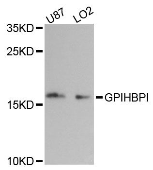 GPIHBP1 Antibody - Western blot analysis of extracts of various cell lines, using GPIHBP1 antibody at 1:3000 dilution. The secondary antibody used was an HRP Goat Anti-Rabbit IgG (H+L) at 1:10000 dilution. Lysates were loaded 25ug per lane and 3% nonfat dry milk in TBST was used for blocking. An ECL Kit was used for detection and the exposure time was 90s.