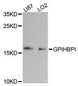 GPIHBP1 Antibody - Western blot analysis of extracts of various cell lines, using GPIHBP1 antibody at 1:3000 dilution. The secondary antibody used was an HRP Goat Anti-Rabbit IgG (H+L) at 1:10000 dilution. Lysates were loaded 25ug per lane and 3% nonfat dry milk in TBST was used for blocking. An ECL Kit was used for detection and the exposure time was 90s.