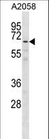 GPKOW Antibody - GPKOW Antibody western blot of A2058 cell line lysates (35 ug/lane). The GPKOW antibody detected the GPKOW protein (arrow).