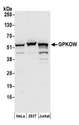 GPKOW Antibody - Detection of human GPKOW by western blot. Samples: Whole cell lysate (50 µg) from HeLa, HEK293T, and Jurkat cells prepared using NETN lysis buffer. Antibodies: Affinity purified rabbit anti-GPKOW antibody used for WB at 0.4 µg/ml. Detection: Chemiluminescence with an exposure time of 30 seconds.