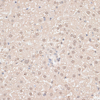 GPKOW Antibody - Immunohistochemistry of paraffin-embedded mouse liver using GPKOW antibody at dilution of 1:100 (40x lens).