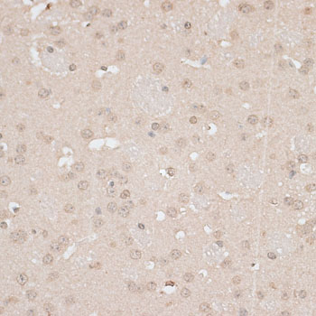 GPKOW Antibody - Immunohistochemistry of paraffin-embedded mouse brain using GPKOW antibody at dilution of 1:100 (40x lens).