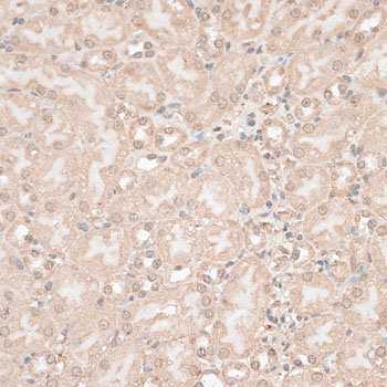 GPKOW Antibody - Immunohistochemistry of paraffin-embedded mouse kidney using GPKOW antibody at dilution of 1:100 (40x lens).