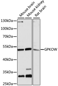 GPKOW Antibody - Western blot analysis of extracts of various cell lines, using GPKOW antibody at 1:3000 dilution. The secondary antibody used was an HRP Goat Anti-Rabbit IgG (H+L) at 1:10000 dilution. Lysates were loaded 25ug per lane and 3% nonfat dry milk in TBST was used for blocking. An ECL Kit was used for detection and the exposure time was 5s.