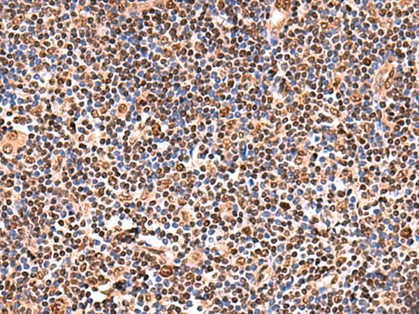 GPKOW Antibody - Immunohistochemistry of paraffin-embedded Human tonsil tissue  using GPKOW Polyclonal Antibody at dilution of 1:140(×200)