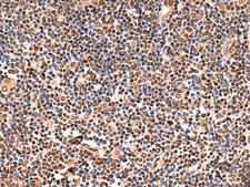 GPKOW Antibody - Immunohistochemistry of paraffin-embedded Human tonsil tissue  using GPKOW Polyclonal Antibody at dilution of 1:140(×200)