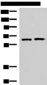 GPKOW Antibody - Western blot analysis of 293T and Jurkat cell lysates  using GPKOW Polyclonal Antibody at dilution of 1:2000