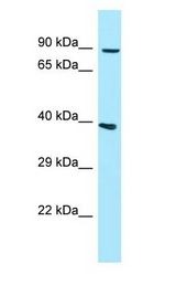 GPLD1 / GPIPLD Antibody - GPLD1 / GPIPLD antibody Western Blot of 721_B.  This image was taken for the unconjugated form of this product. Other forms have not been tested.
