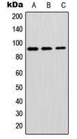 GPLD1 / GPIPLD Antibody - Western blot analysis of GPIPLD expression in A549 (A); mouse brain (B); H9C2 (C) whole cell lysates.