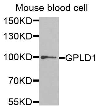 GPLD1 / GPIPLD Antibody - Western blot analysis of extracts of mouse blood cells.