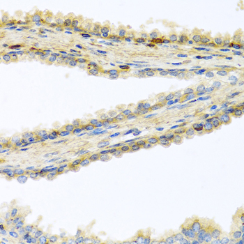 GPLD1 / GPIPLD Antibody - Immunohistochemistry of paraffin-embedded human prostate.