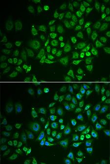 GPLD1 / GPIPLD Antibody - Immunofluorescence analysis of A549 cells.