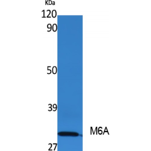 GPM6A / Glycoprotein M6A Antibody - Western blot of M6A antibody