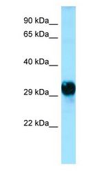 GPM6A / Glycoprotein M6A Antibody - GPM6A / M6A antibody Western Blot of Human brain.  This image was taken for the unconjugated form of this product. Other forms have not been tested.