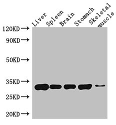 GPM6A / Glycoprotein M6A Antibody - Western Blot Positive WB detected in: Mouse liver tissue, Mouse spleen tissue, Mouse brain tissue, Mouse stomach tissue, Mouse skeletal muscle tissue All lanes: GPM6A antibody at 4µg/ml Secondary Goat polyclonal to rabbit IgG at 1/50000 dilution Predicted band size: 32, 31, 30 kDa Observed band size: 32 kDa