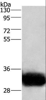 GPM6A / Glycoprotein M6A Antibody - Western blot analysis of Human fetal brain tissue, using GPM6A Polyclonal Antibody at dilution of 1:950.