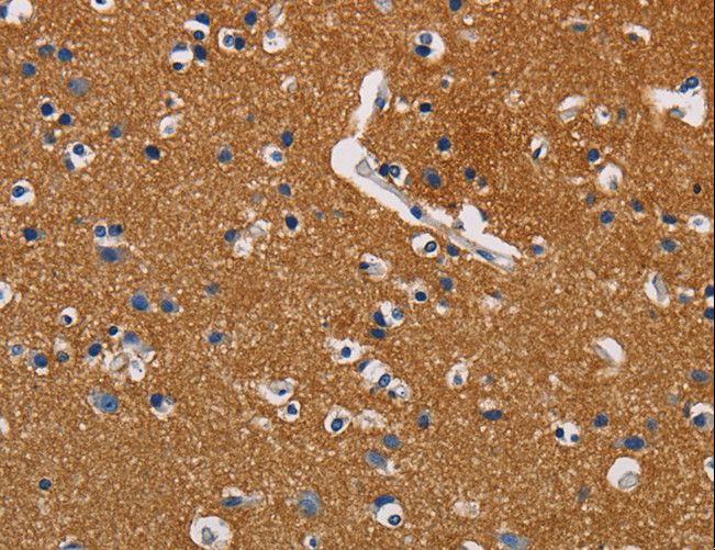 GPM6A / Glycoprotein M6A Antibody - Immunohistochemistry of paraffin-embedded Human brain using GPM6A Polyclonal Antibody at dilution of 1:40.