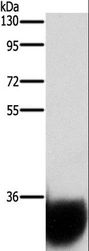 GPM6A / Glycoprotein M6A Antibody - Western blot analysis of Human fetal brain tissue, using GPM6A Polyclonal Antibody at dilution of 1:1050.