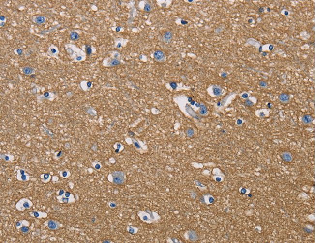 GPM6A / Glycoprotein M6A Antibody - Immunohistochemistry of paraffin-embedded Human brain using GPM6A Polyclonal Antibody at dilution of 1:50.