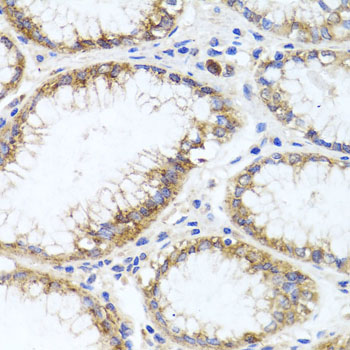 GPM6A / Glycoprotein M6A Antibody - Immunohistochemistry of paraffin-embedded human stomach tissue.