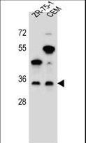 GPM6B Antibody - GPM6B Antibody western blot of ZR-75-1,CEM cell line lysates (35 ug/lane). The GPM6B antibody detected the GPM6B protein (arrow).
