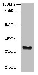 GPM6B Antibody - Western blot All lanes: GPM6B antibody at 5µg/ml + Mouse brain tissue Secondary Goat polyclonal to rabbit IgG at 1/10000 dilution Predicted band size: 29, 27, 34, 37 kDa Observed band size: 29 kDa