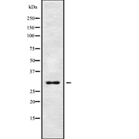 GPM6B Antibody - Western blot analysis GPM6B using Jurkat whole cells lysates