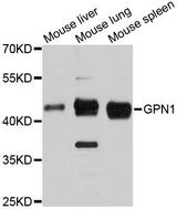 GPN1 / XAB1 Antibody - Western blot analysis of extracts of various cell lines, using GPN1 antibody at 1:3000 dilution. The secondary antibody used was an HRP Goat Anti-Rabbit IgG (H+L) at 1:10000 dilution. Lysates were loaded 25ug per lane and 3% nonfat dry milk in TBST was used for blocking. An ECL Kit was used for detection and the exposure time was 90s.