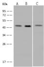 GPN1 / XAB1 Antibody - Anti-GPN1 rabbit polyclonal antibody at 1:500 dilution. Lane A: HL-60 Whole Cell Lysate. Lane B: HeLa Whole Cell Lysate. Lane C: U-251 MG Whole Cell Lysate. Lysates/proteins at 30 ug per lane. Secondary: Goat Anti-Rabbit IgG (H+L)/HRP at 1/10000 dilution. Developed using the ECL technique. Performed under reducing conditions. Predicted band size: 42 kDa. Observed band size: 44 kDa.