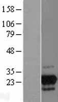 GPN2 Protein - Western validation with an anti-DDK antibody * L: Control HEK293 lysate R: Over-expression lysate