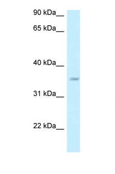 GPN3 Antibody - GPN3 antibody Western blot of 721_B Cell lysate. Antibody concentration 1 ug/ml.  This image was taken for the unconjugated form of this product. Other forms have not been tested.