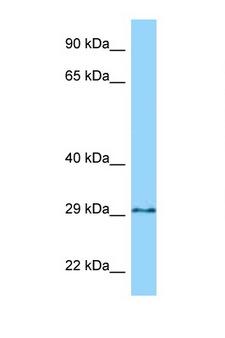 GPN3 Antibody - GPN3 antibody Western blot of 435S Cell lysate. Antibody concentration 1 ug/ml.  This image was taken for the unconjugated form of this product. Other forms have not been tested.