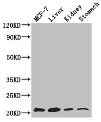 Gpnat1 / GNPNAT1 Antibody - Western Blot Positive WB detected in: MCF-7 whole cell lysate, Mouse liver tissue, Mouse kidney tissue, Mouse stomach tissue All lanes: GNPNAT1 antibody at 3.4µg/ml Secondary Goat polyclonal to rabbit IgG at 1/50000 dilution Predicted band size: 21 kDa Observed band size: 21 kDa
