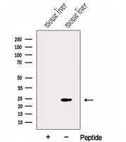 Gpnat1 / GNPNAT1 Antibody - Western blot analysis of extracts of mouse liver tissue using GNPNAT1 antibody. The lane on the left was treated with blocking peptide.