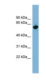 GPNMB / Osteoactivin Antibody - GPNMB antibody Western blot of PANC1 cell lysate.  This image was taken for the unconjugated form of this product. Other forms have not been tested.