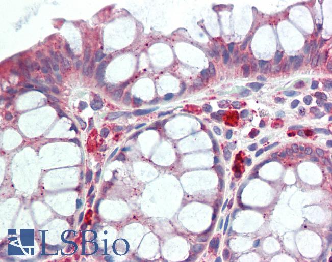 GPNMB / Osteoactivin Antibody - Anti-GPNMB antibody IHC staining of human colon. Immunohistochemistry of formalin-fixed, paraffin-embedded tissue after heat-induced antigen retrieval. Antibody concentration 10 ug/ml.  This image was taken for the unconjugated form of this product. Other forms have not been tested.