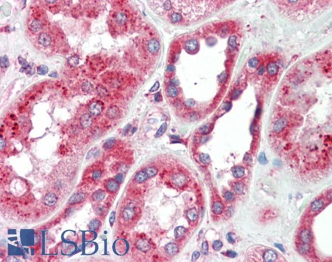 GPNMB / Osteoactivin Antibody - Anti-GPNMB antibody IHC staining of human kidney. Immunohistochemistry of formalin-fixed, paraffin-embedded tissue after heat-induced antigen retrieval.  This image was taken for the unconjugated form of this product. Other forms have not been tested.