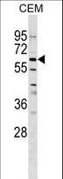 GPNMB / Osteoactivin Antibody - GPNMB Antibody western blot of CEM cell line lysates (35 ug/lane). The GPNMB antibody detected the GPNMB protein (arrow).