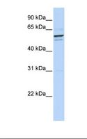 GPNMB / Osteoactivin Antibody - 293T cell lysate. Antibody concentration: 1.0 ug/ml. Gel concentration: 12%.  This image was taken for the unconjugated form of this product. Other forms have not been tested.