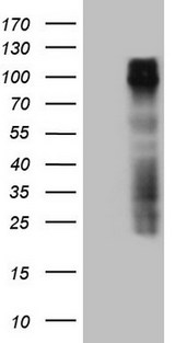 GPNMB / Osteoactivin Antibody - HEK293T cells were transfected with the pCMV6-ENTRY control. (Left lane) or pCMV6-ENTRY GPNMB. (Right lane) cDNA for 48 hrs and lysed. Equivalent amounts of cell lysates. (5 ug per lane) were separated by SDS-PAGE and immunoblotted with anti-GPNMB. (1:2000)